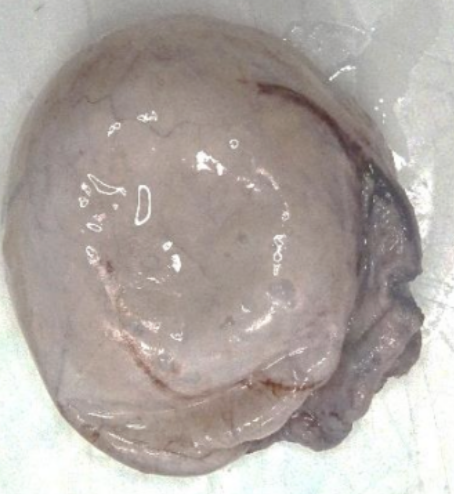 Description of the image